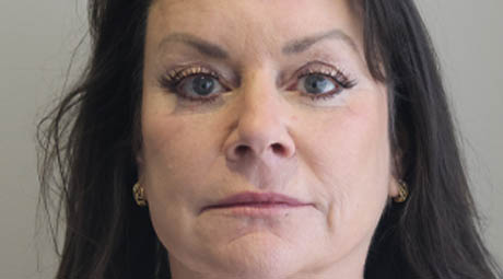 1_0000_Full Face After.jpg