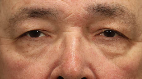 1_0005_maleupperlids (2).jpg