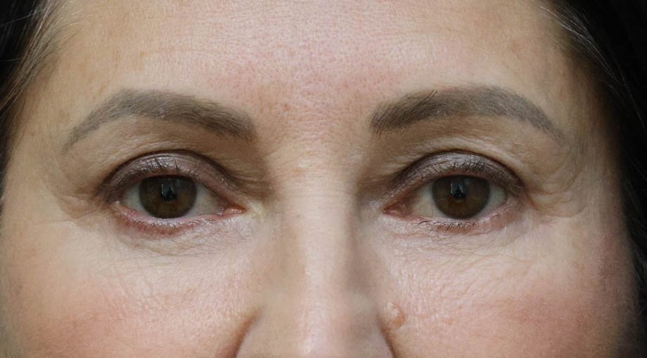 q_0001_RA AFTERlbfgk.JPG