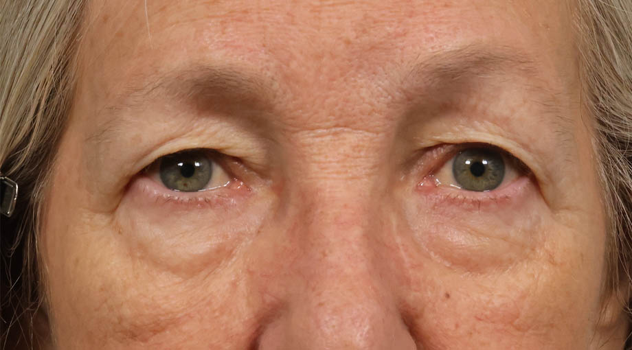 q_0004_KA BEFORE.JPG