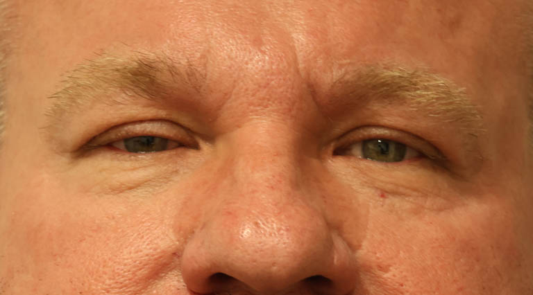 1_0010_CCupperptosis (2).jpg