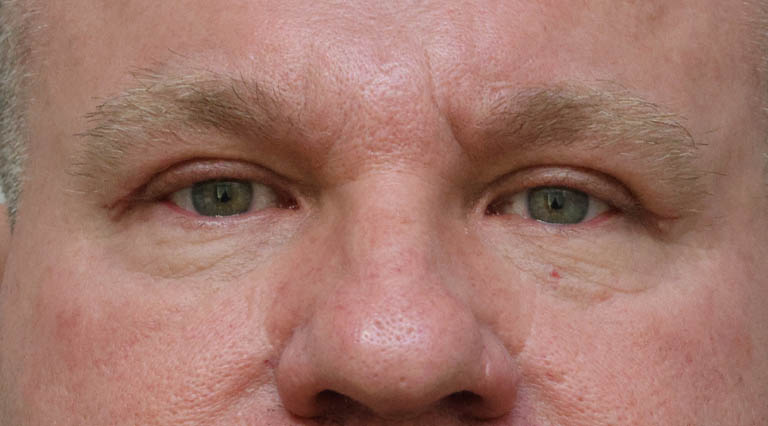 1_0011_CCupperptosis (1).jpg