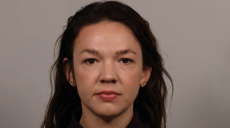 1_0003_FE- Full Face Upper Bleph Before.JPG