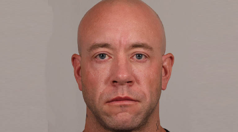 1_0006_HR- Full Face Lower Bleph After.JPG