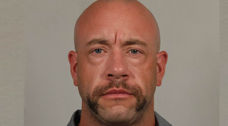 1_0007_HR- Full Face Lower Bleph Before.JPG